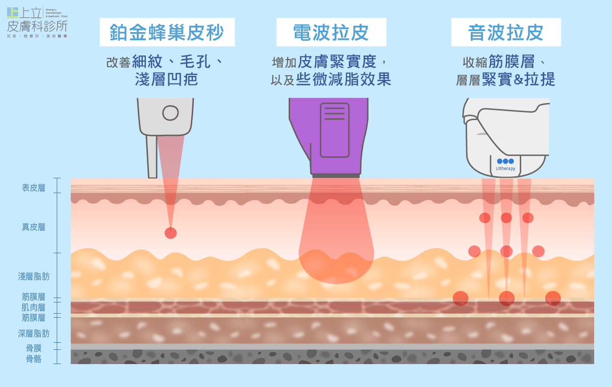 儀器號稱的「膠原蛋白新生」⋯⋯ 鉑金蜂巢皮秒、電波、音波，各有不同的作用深度