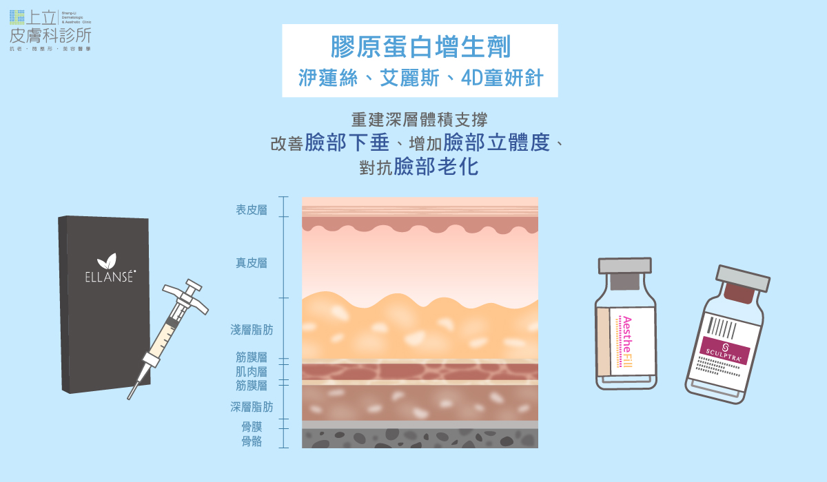 透過注射的方式，把「可以長膠原蛋白的東西」送到這些深度裡面去，也就是俗稱「膠原蛋白新生材質」的一些注射材質
