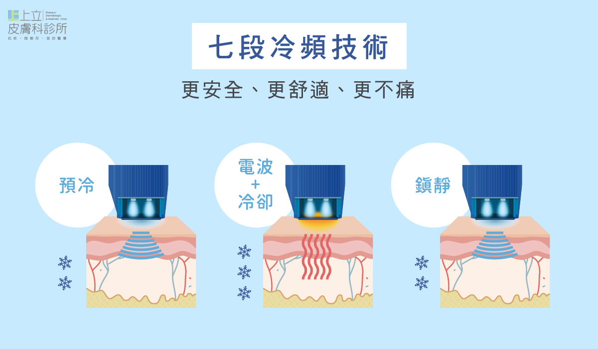 十倍電波搭載創新的「七段冷噴技術」