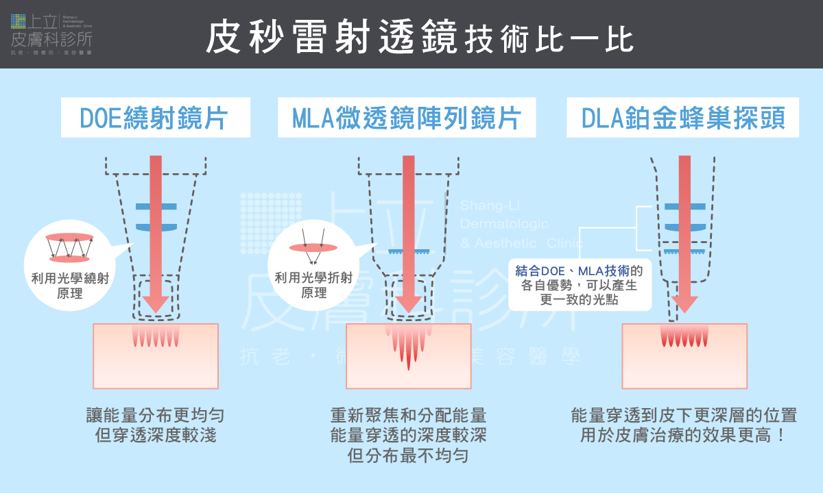 PicoSure系列最著名的「透鏡」技術