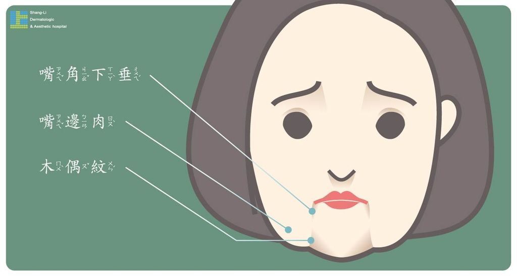 木偶紋、嘴邊肉、嘴角下垂就像三胞胎，總是會伴隨著一起出現