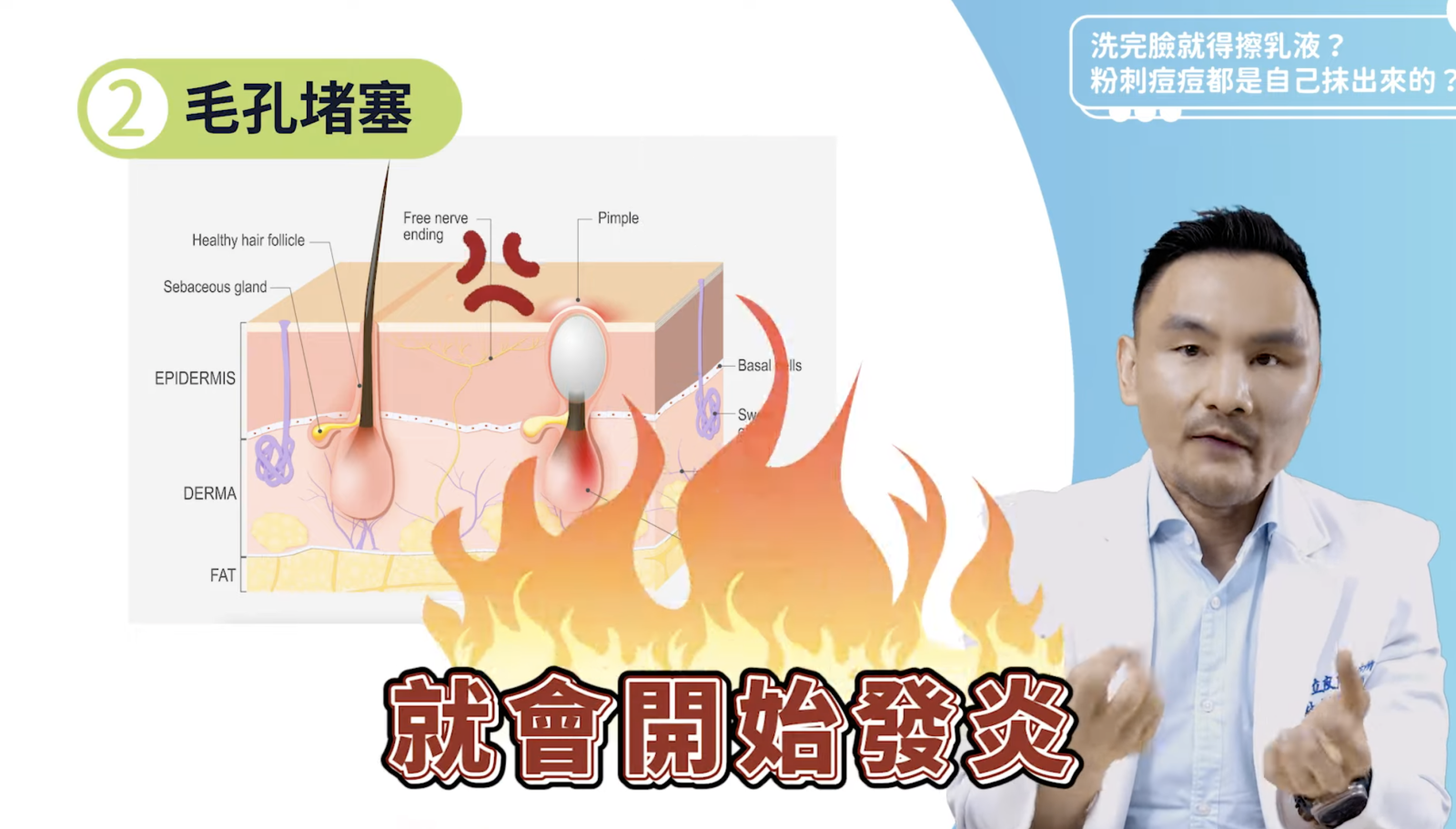 毛孔沒有辦法正常把老舊角質、油脂給代謝出去，就會造成毛孔堵塞